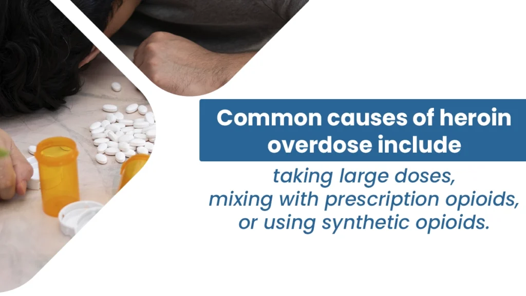 A heroin overdose occurs when excessive heroin use leads to slowed breathing, loss of consciousness, and potentially fatal complications.
